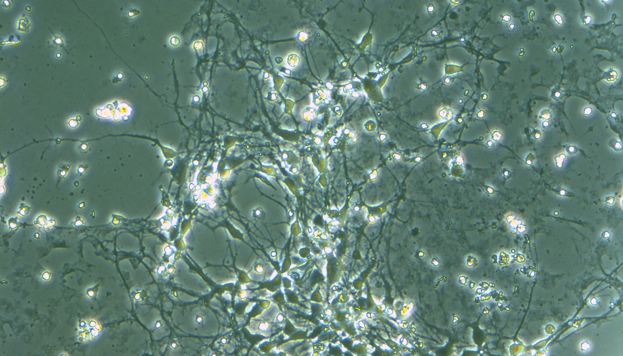 20250611 press takumi thumb